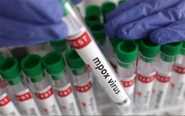 युगांडा में mpox के मामले 4,342 तक पहुंचे, मृतकों की संख्या 31 हुई