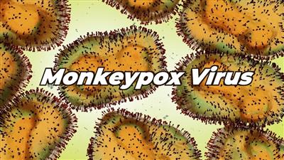 Woman, baby infected with monkeypox after returning to SL from Dubai