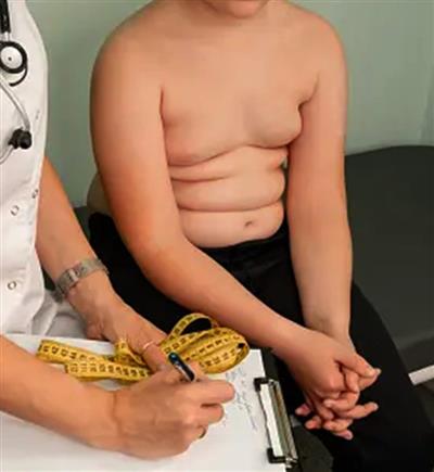 Early treatment may help curb child obesity: Study