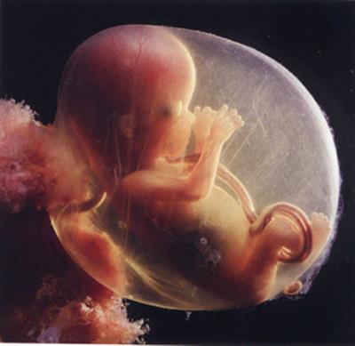 Karnataka foeticide scam: Foetuses thrown in dustbin & left to decompose with medical waste