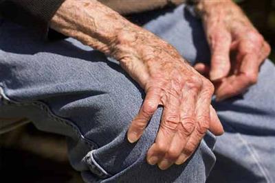Study shows rheumatoid arthritis drug may prevent disease progression