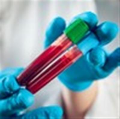 New strategy may enable accurate cancer monitoring from blood tests alone