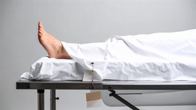 Two dead after consuming adulterated toddy in Hyderabad
