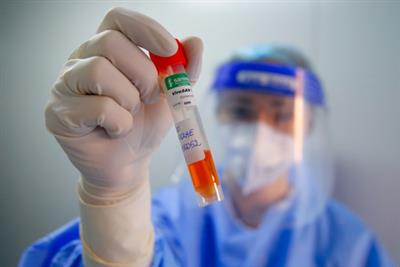Romania reports 1,703 new Covid cases, seven deaths in July